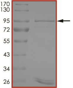 EGFR (d746-750 T790M C797G) Protein